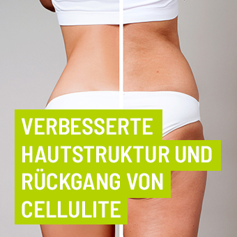 Verbesserte Hautstruktur und Rückgang von Cellulite